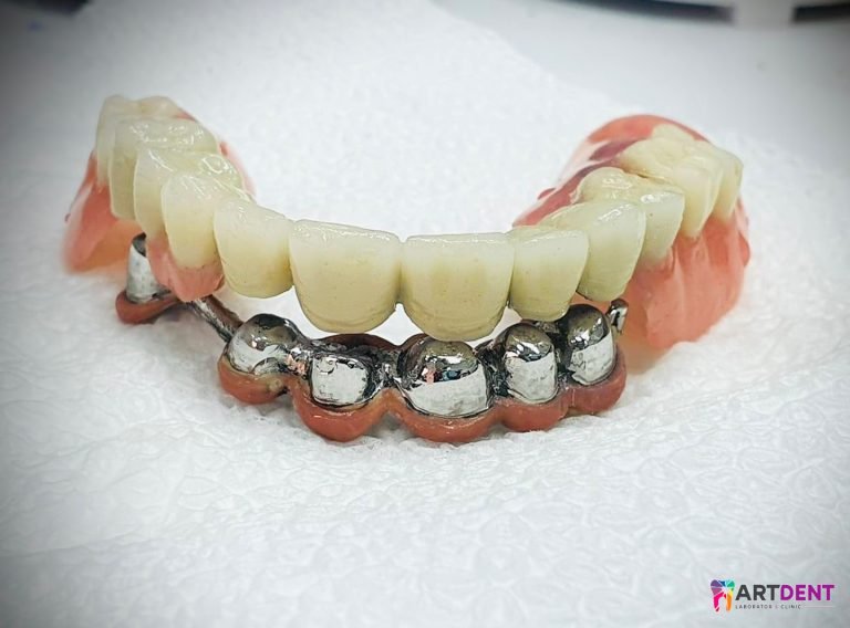 Dental Services Art Dent Clinic